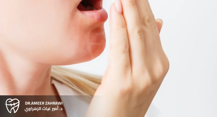 رائحة الفم الكريهة