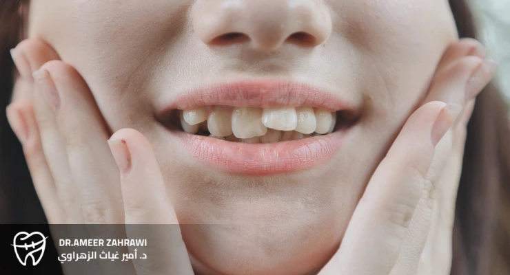 أسباب التواء الأسنان