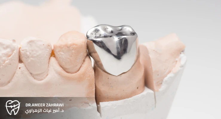 التيجان المعدنية