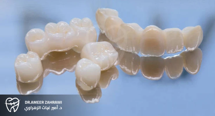 التيجان الراتنجية