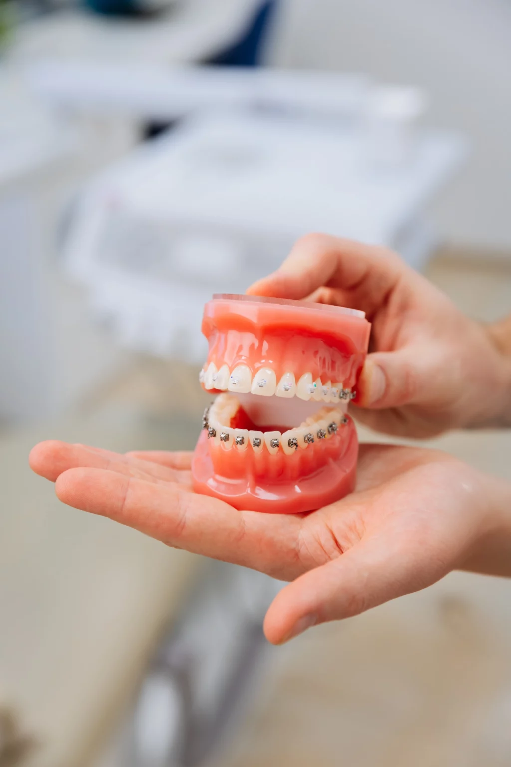 خدمات تقويم الأسنان