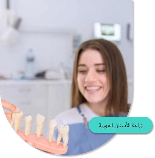 زراعة الأسنان الفورية