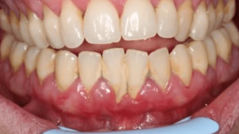 The Latest Laser Treatment Techniques and How They Work
