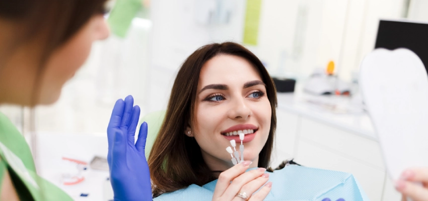 dental veneers