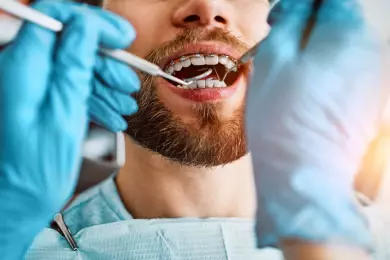 كيف يقرر طبيب التقويم بين التقويم أم خلع الأسنان؟