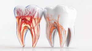 Exposed tooth roots: causes and treatment options