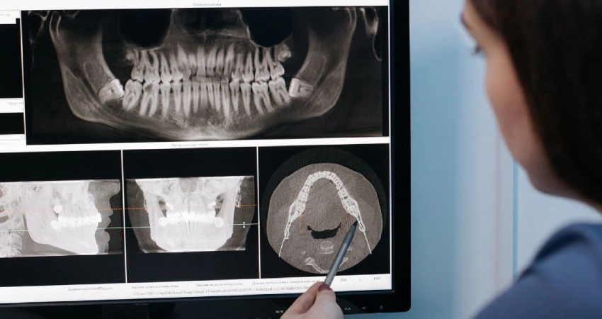 dental X-rays